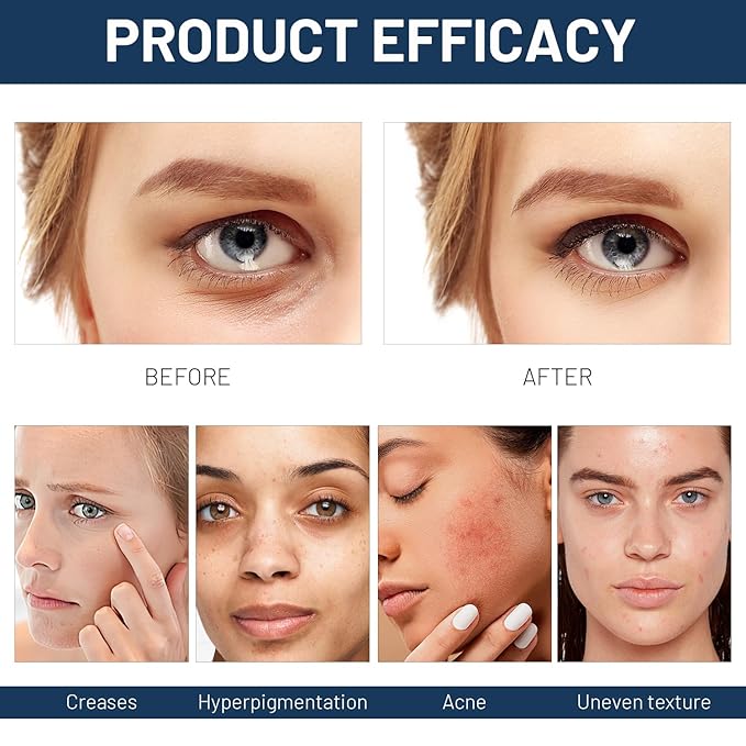 2 Pcs Paracress Facial Oil, Paracress Oil for Face, Paracress Serum, Paracress Facial Serum Organic, Smooth Fine Lines and Wrinkles, Natural Face Oil for All Skin Types 30ML/1oz