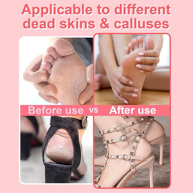 Electric Foot File - High Torque,Callus Remover for Feet,Adjustable Speed Foot File with 60 Pcs Sandpaper Discs,Professional Pedicure Tool for Dead Skin and Calluses (Red)