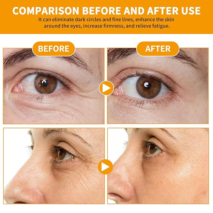 Vitamin C Eye Cream Puffiness Remover Eye Serum Anti-aging & Moisturising Vitamin C Eye Serum Eye Bags Treatment for Men and Women