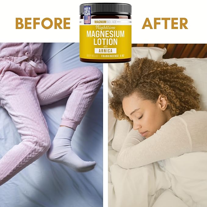 Nighttime Magnesium Lotion with Arnica – Soothing Relief & Relaxation, Highly Concentrated Magnesium for Muscles & Joints – Apply to Legs or Feet Before Bed – Skin-Friendly