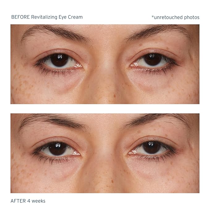 Santo Remedio, Piel Eterna, Revitalizing Eye Cream, Illuminating Eye Cream, Helps Reduce Dark Circles, Contains Marina Algae, Caffeine, Aloe, Hyaluronic Acid, Vitamin E, For All Skin Types, 1 Fl. Oz.