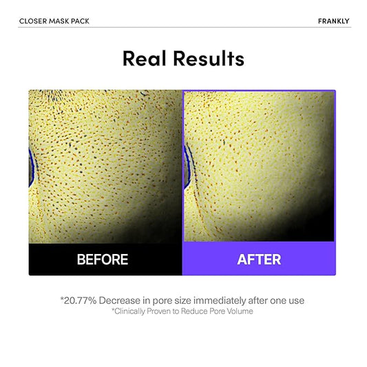 FRANKLY Closer Pore Minimizing Mask,10 sheets – Korean Semi-Gel Face Mask for Pore Care, Hydration & Firming | Korean Skin Care with Collagen, Triple Hyaluronic Acids & Peptides | 0.74 fl oz*10 EA