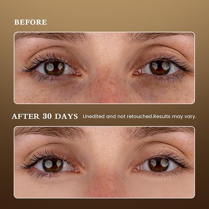 Puffy Eyes Smoothing Under Eye Patches, Caffeine Eye Masks for Wrinkles and Dark Circles, Undereye Bags, Brightening Skincare Treatment for Men & Women, Vegan & USA Tested