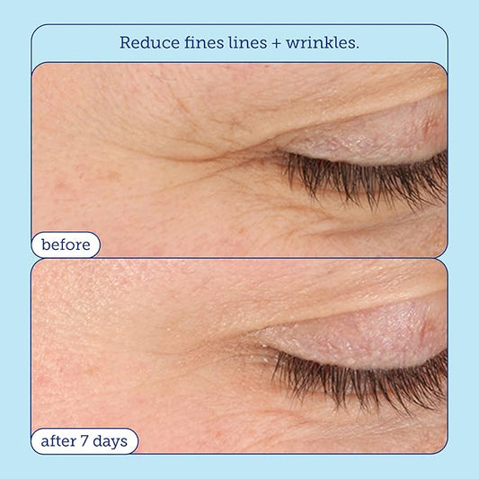 Skinfix Barrier+ Triple Lipid-Boost 360° Eye Cream: Targets Dark Circles, Puffiness, and Fine Lines Around Eyes and Lids, Clinically Proven to Brighten and Refresh Eyes, 0.5 oz