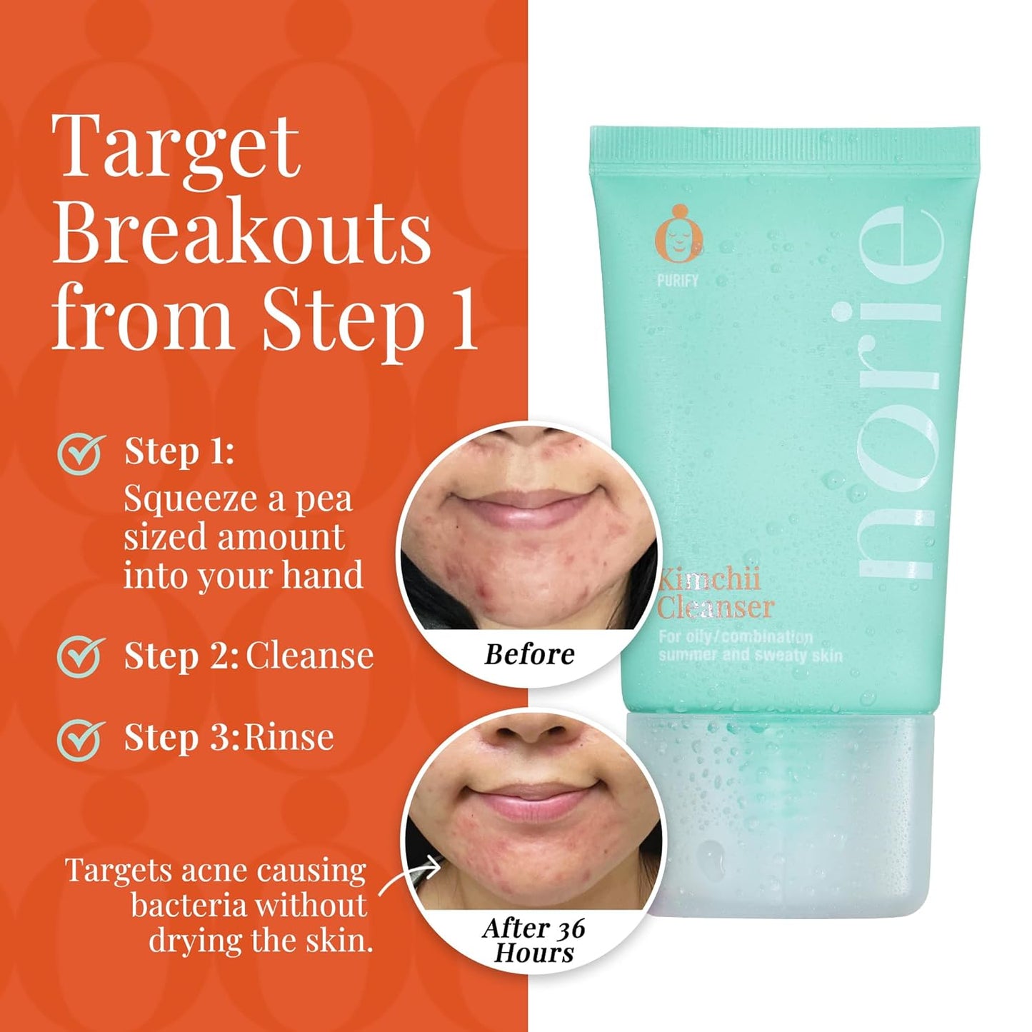 Norie Kimchii Face Wash - Gentle Facial Cleanser for Dry, Oily & Sensitive Skin | Fragrance Free Gel for Clearer Skin 2% Salicylic Acid, Vegan, Unscented 1.7oz