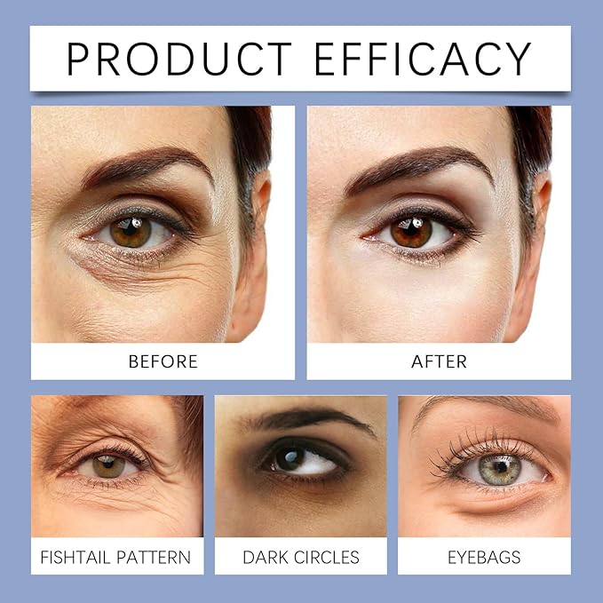 Malora & Novalift Microglow Eye Patches, Renford & Baani Hyaluronic Patches for Under Eyes Bags and Wrinkles, Elegear Women Face Microglow Eye Mask Facial Wrinkle Patches for Hydration & Soothing