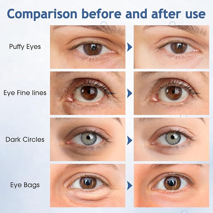 Under Eye Patches, 60 Pcs, Eye Mask for Puffy Eyes, Dark Circles, Eye Bags, Wrinkles, Collagen, Hyaluronic Acid, Castor Oil