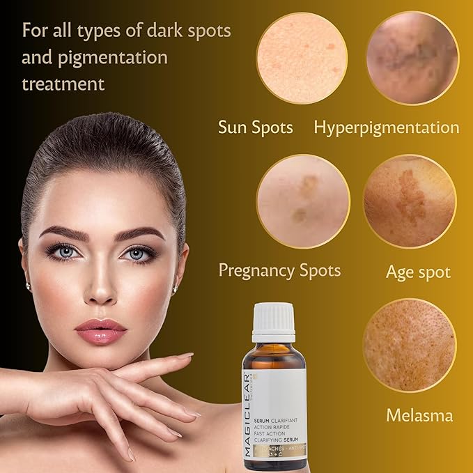 Luxury Swiss Dark Spot Remover for Face Body Serum Age Sun Brown Spot Freckles Corrector Melasma treatment Anti aging Skin Vitamin C + Niacinamide organic Magiclear