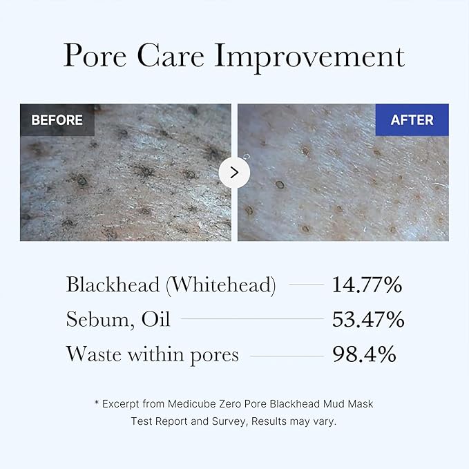 medicube Zero Pore Blackhead Mud Facial Mask - Skin Cooling & Pore Tightening - 3 Minute Quick Dry Formula with AHA, BHA, PHA, and Pore-Purifying Clay - Korean Mud Mask 3.52 oz