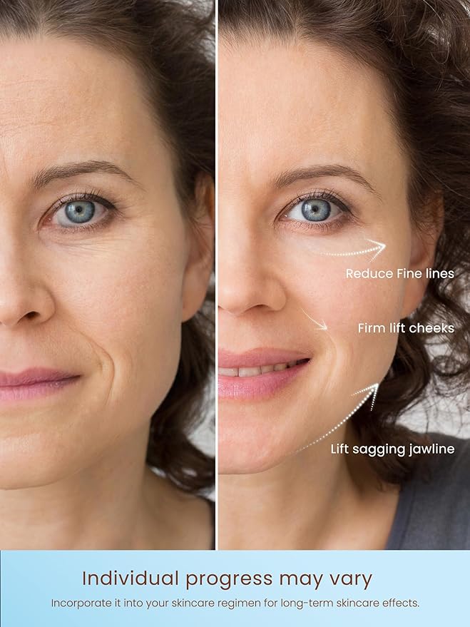 Radio Frequency Skin Tightening Device, Smart Electric Zinc Alloy Facial Beauty Machine with RF-Current Cold Heat for Jawline Lifting, Cheek Firm, Wrinkle Reduction, Depuff, Increase Absorption