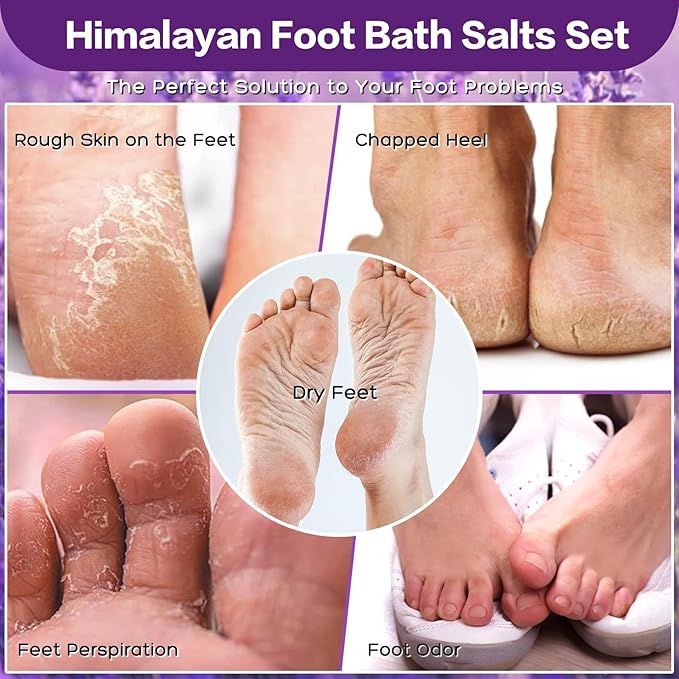 Himalayan Pink feet soka Salt 3 Set Kit Lavender Scent Orange Scent Rose Scent Foot Soak Salts with Epsom Set-Foot Athletes Foot spa Itching,Foot Bath Salt Tea Tree Oil Foot Care