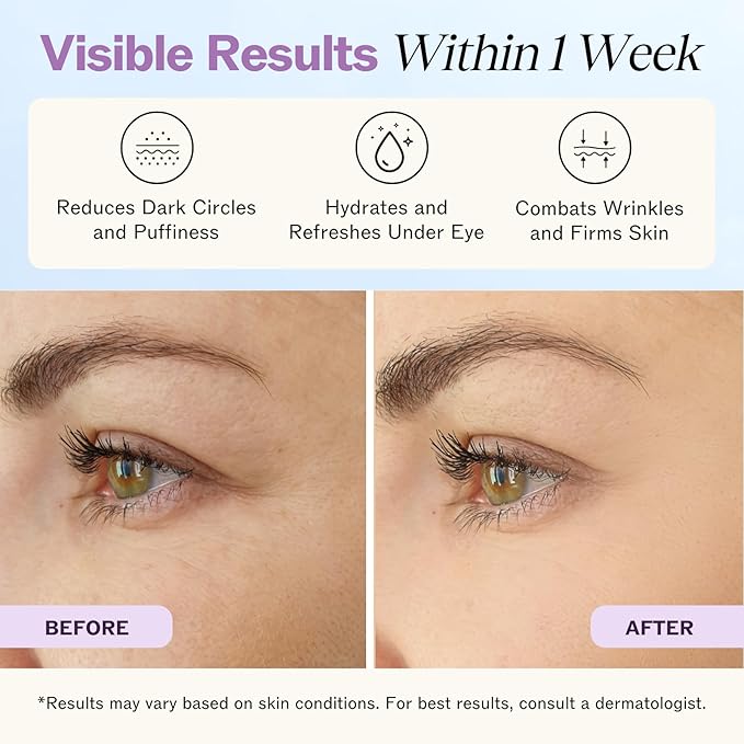 LilyAna Naturals Eye Cream for Dark Circles and Puffiness, Under Eye Cream for Wrinkles and Bags, Anti Aging - helps Improve Dryness; for Sensitive Skin - 1.7 oz - Made in USA