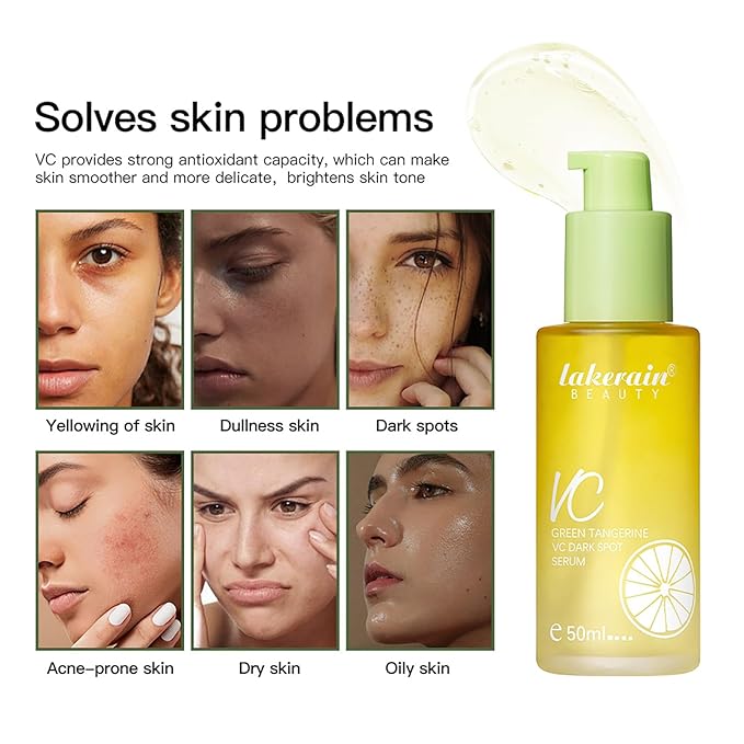 NICEFACE Green Tangerine Vitamin C Face Serum - Facial Serum with Vitamin C, Niacinamide & More - Brightening Serum for Dark Spots, Balancing Skin Tone, and Lightening Acne Marks (50ml), transparent