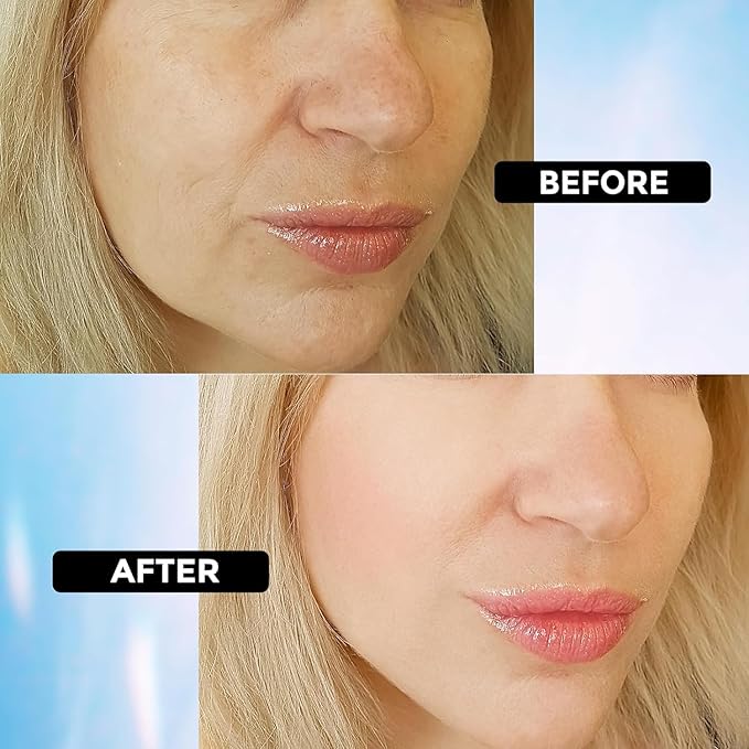 Hyaluronic Acid Serum for Face Anti Aging, Fine Lines, Dark Spots, & Dry Skin - Hydrating Facial Serum - Best Face Serum for Moisturizing and Wrinkle Reducing, 1 fl oz