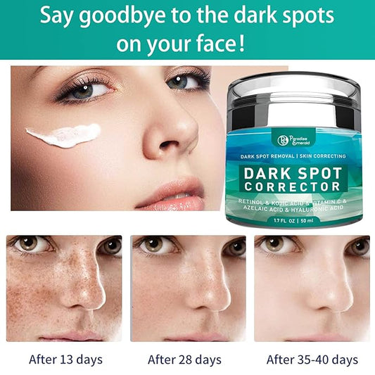 Dark Spot Remover for Face, Hyperpigmentation Treatment, Melasma, Freckle, Sun Spots Removal for All Skin Types Dark Spot Corrector for Men and Women