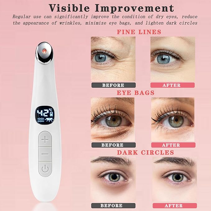 Eye Lift Wand, 3 in 1 Vibrating Red Light 98°F to 113°F LCD Display Eye Massager for Dry Eyes, Dark Circles and Puffiness, Electrical Face, Neck Sculpting Pen for Fine Lines and Wrinkles