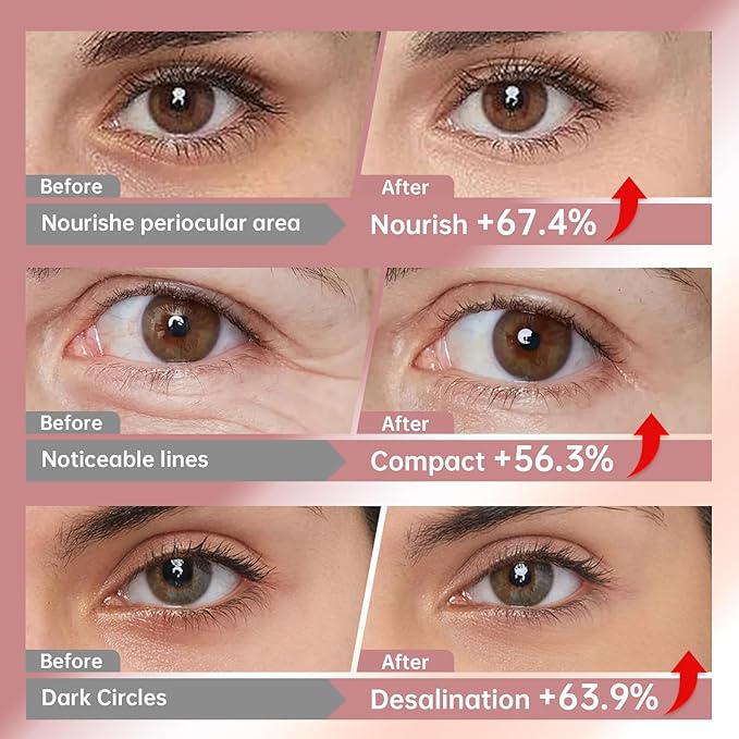 Novoy 7 Pairs Bio-Collagen Real Deep Eye Patches - 6-in-1 Retinol Overnight Eye Patches for Dark Circles, Puffiness & Wrinkles | 2% Caffeine+Hyaluronic+Niacinamide, Korean Popular Eye Mask - Lavender