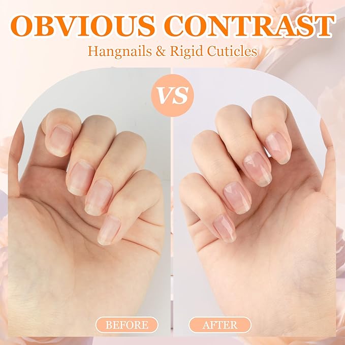 Meschett Cuticle Oil Pens with Nail File for Nail Care, 4PCS Nail Pen Oil with Natural Ingredients, Fingernails and Toenails Oil Cuticle for Repairing Cracked(Mix Flavors)