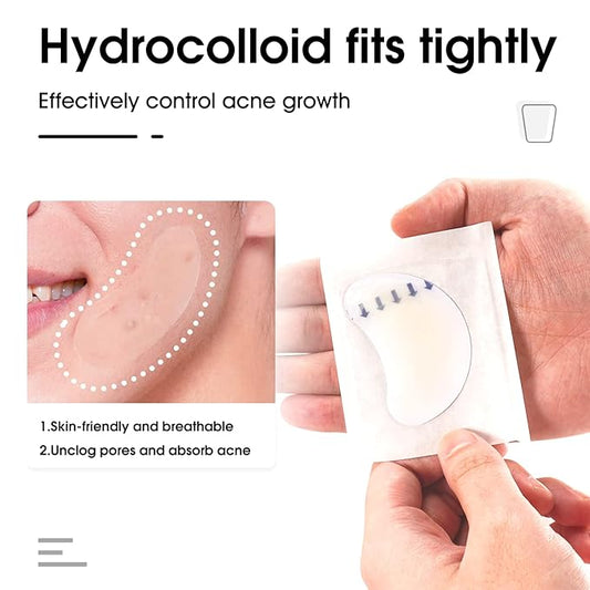 Hydrocolloid Acne Patch(20 Patches), Large Spot Control Cover With Long Size, Extra Larger Acne Pimple Patch for Covering Large Breakouts, Spot Patch, Stickers for Body, Cheek, Forehead, and Chin