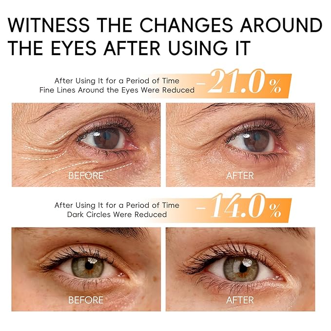 Lumibalm for Under Eye Bags, Turmeric Retinol Eyes Stick, Turmeric Eye Cream Stick, Retinol Eye Cream Sticks, Under Eye Creams Anti Aging, Eye Balm with Eye Stick for Dark Circles Puffiness (2pcs)