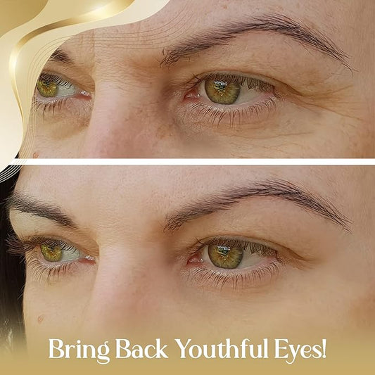 OROGOLD 24K Intensive Eye Serum - Under Eye Serum for Dark Circles, Puffiness - 1.76 Fl Oz