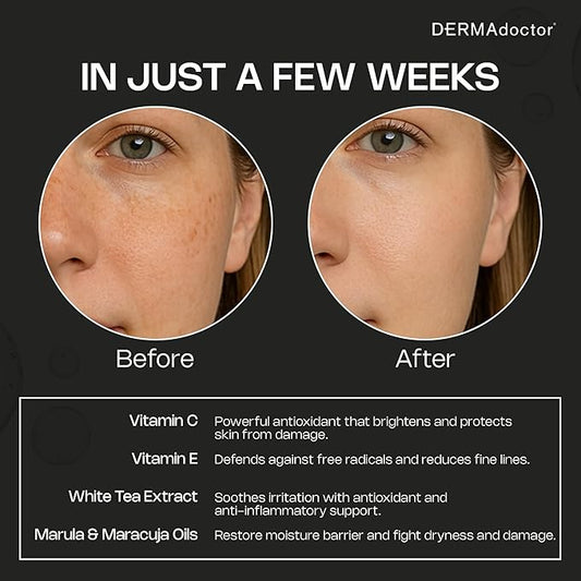 DERMAdoctor 20% Vitamin C Face Oil with Vitamin E & Ferulic Acid | Kakadu C High-Potency Evening Oil, Anti-Aging, Brightening & Hydrating Glow | For All Skin Types – 1.01 fl oz