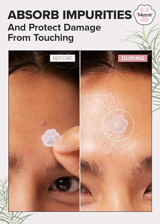 I DEW CARE Facial Skin Care Set - Glow Up Bubble & Timeout Blemish Patch & Headband | Face Sheet Mask, Cute Pimple Patches, Clear and Soothe Irritation, Blemish Treatment, Mother's Day