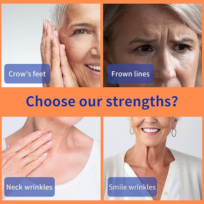 HYPOD Pdo Threads for Face Lift, Pdo Lifting Thread Whole Body Mono Screw Type, Pdo Thread Lift Mono Korea (20PCS-30G*38MM)