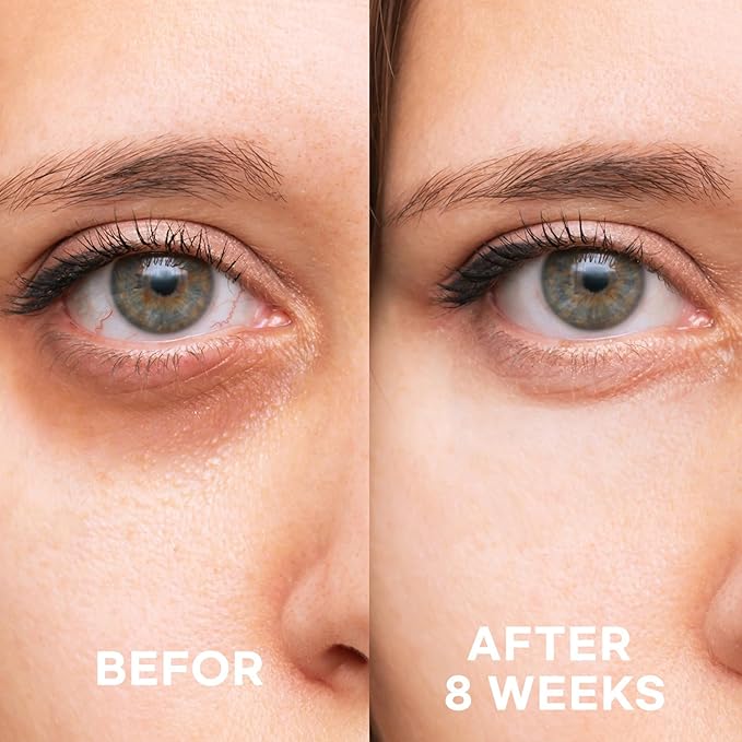 Epielle Firming Eye Cream | Anti-Aging Serum for Sagging Skin and Wrinkles | Cooling Applicator for Refreshing Application | Korean Skincare