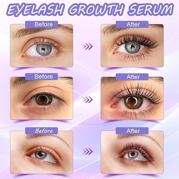 Premium Eyelash Growth Serum and Eyebrow Enhancer by Aomock, Lash Serum - 5ml,Lash Boost Serum for Longer, Fuller, Thicker Lashes & Brows…