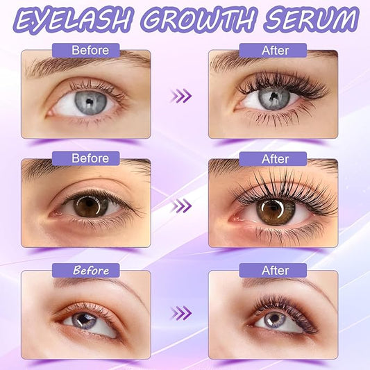 Premium Eyelash Growth Serum and Eyebrow Enhancer by Aomock, Lash Serum - 5ml,Lash Boost Serum for Longer, Fuller, Thicker Lashes & Brows…