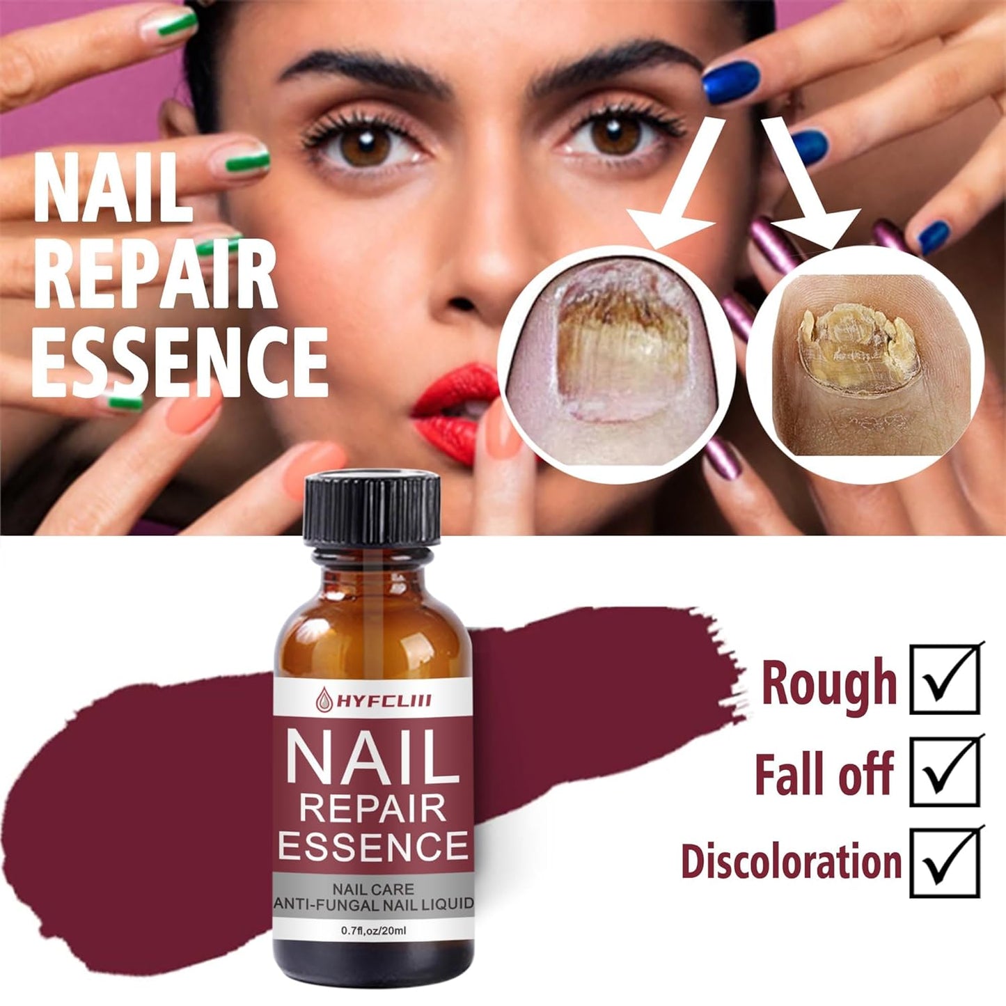 Nail Repair Essence Serum Nail Treatment Multi-Purpose Nail Repair Liquid Solution for Damaged Nails repair for Discolored Nails Ingrown Treatment Extra Strength Nail Care 0.7 Fl Oz