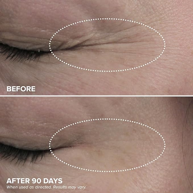 DRMTLGY Dark Circles Bundle - Medium: Luminous Eye Corrector SPF 41 & HPR Eye Cream