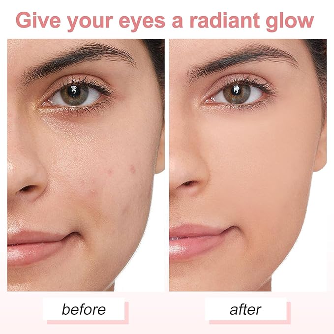 Skin Care Eye Cream Under Eye Cream for Dark Circles and Wrinkles Under Eye Brightener for Women and Men