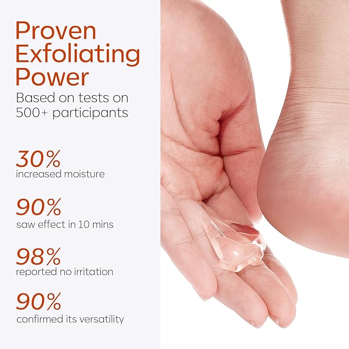 modelones Callus Remover for Feet, Callus Remover Gel Foot Scrubber for Dry, Cracked & Dead Skin, Extra Strength Pedicure Foot Spa Products, Salon Grade Callus Remover, Pedicure Tools for Feet, 8.1 Oz