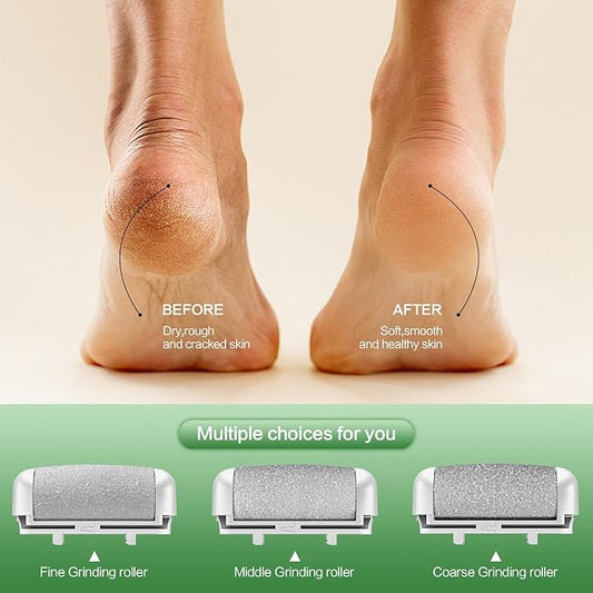 Electric Foot Callus Remover, LED Light & Display Electric Foot File, Rechargeable Waterproof Electric Foot Filer, 3 Replacement Rollers & USB-C Charging Foot Sanders for Feet White