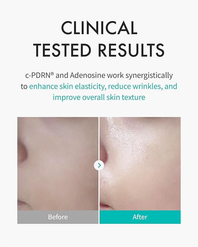 REJURAN® Turnover Mask, c-PDRN® (5ea) – Firming & Repairing Ultra Microfiber Sheet Mask for Youthful, Glass Skin with Salmon DNA. Korean Skin Care