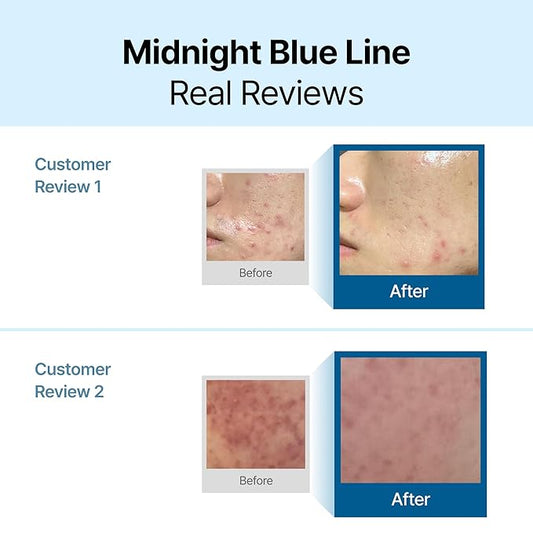 DearKlairs] Midnight Blue Calming Cream, Soothing, Redness Relief Moisturizer, Hydrating, Fast Absorbing, Light Texture for Easy Use, Sensitive Skin Friendly (1.01 Fl Oz (Pack of 1))