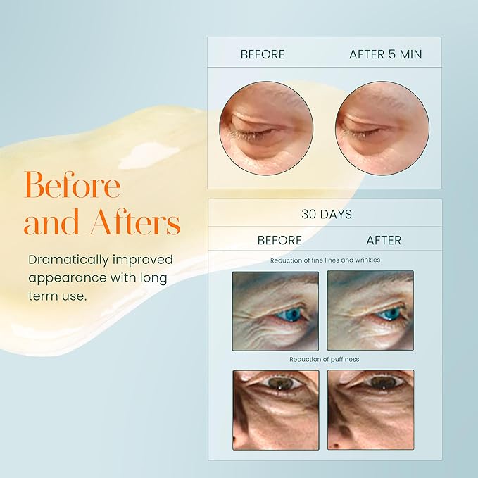 Hylunia Intensive Repair Eye Cream – Hydrating & Firming with Peptides, Vitamin C & Hyaluronic Acid – Reduces Dark Circles, Puffiness & Fine Lines – Lightweight, Vegan, Clean Skincare