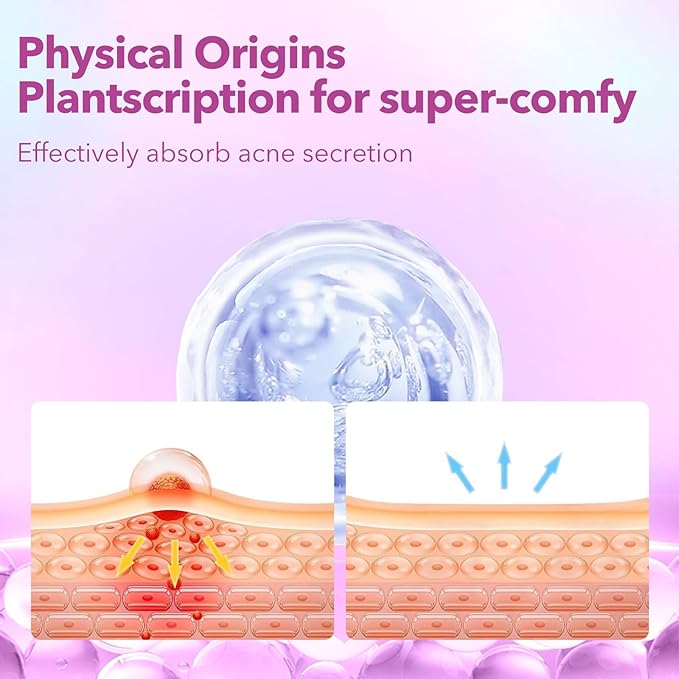 Pimple Patches for Face, Hydrocolloid Acne Patches, Cute Star Zit Covers for Face, Colorful Spot Stickers with Tea Tree, Salicylic Acid & Cica Oil| 3 Sizes (10mm, 12mm & 14mm) |280 Count