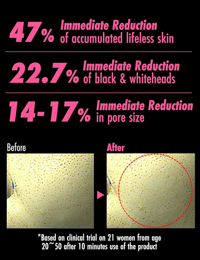 Meditime Pore Corset Pack | Sebum and Pore Minimizer Face Pack | Clay Mask for Blackheads and Pores | Korean Skincare Pore Cleaner & Nose Blackhead Remover | Deep Pore Remover Face Care (3.53 Fl Oz)