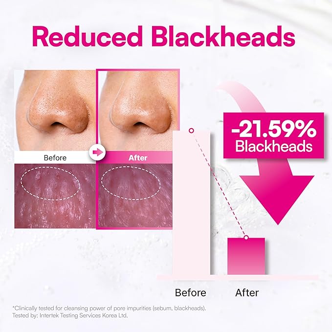 Face Republic Blooming Rose Melt & Remove Pore Cleansing Oil 150ml 5.07 fl oz | Oil Cleanser for Face | Pore and sebum care, Blackhead remover | Waterproof Makeup remover | Vegan Korean Skin Care