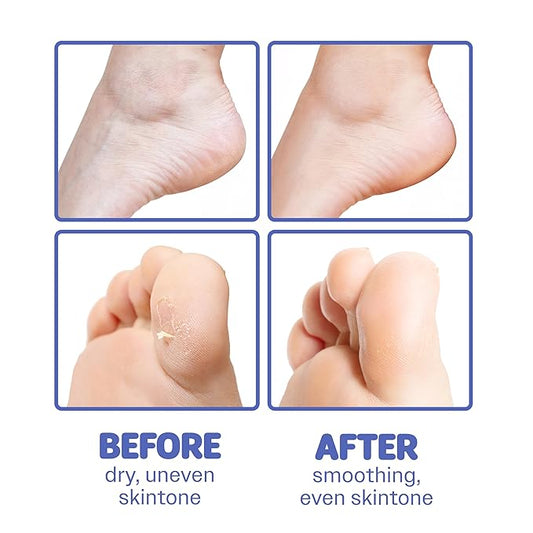 ONSOI 12PK Foot Masks for Soft, Smooth, Moisturizing Foot Mask for Dry Cracked Feet, Baby Feet - Coconut & Shea Butter (12PK Coconut & Shea Butter)