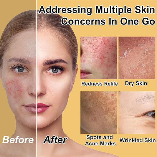 Skin Care Set for Teens Womens,Anti-Aging Deeply Hydrates Repairs Skincare Gift Set for All Skin,Facial Skin Care Products Routine Kit Christmas Beauty Gift Set for Women Stocking Stuffers