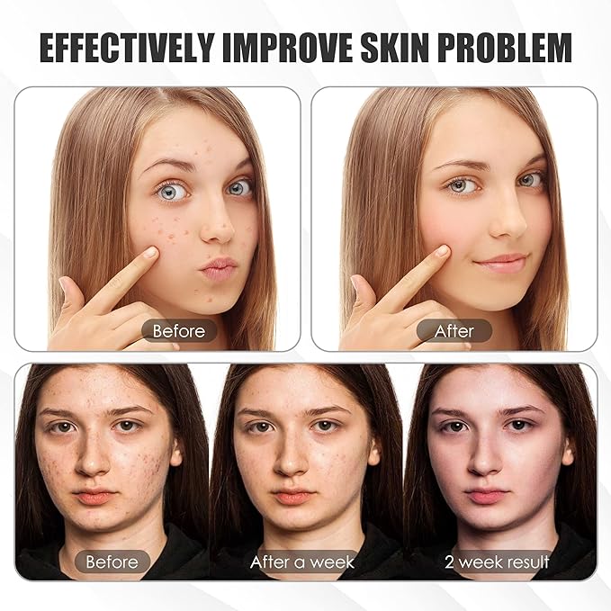 Red Light Therapy for Face, 7 Colors Light Therapy Facial Mask for Skin Care at Home