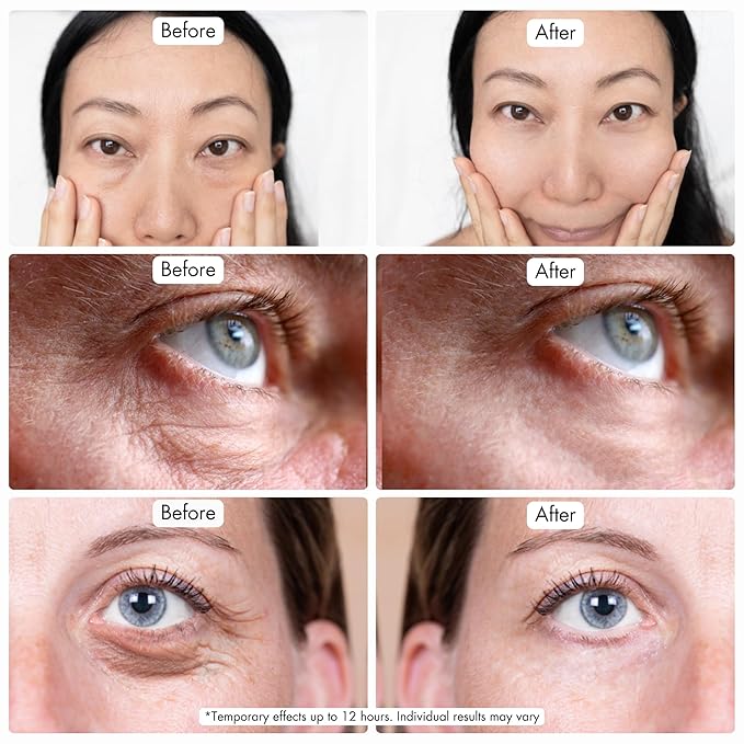 Instant Under Eye Bag Remover – Anti-Aging Under Eye Cream for Dark Circles and Puffiness - Rapid Eye & Face Lift – No Flakes or Residue – 10ml