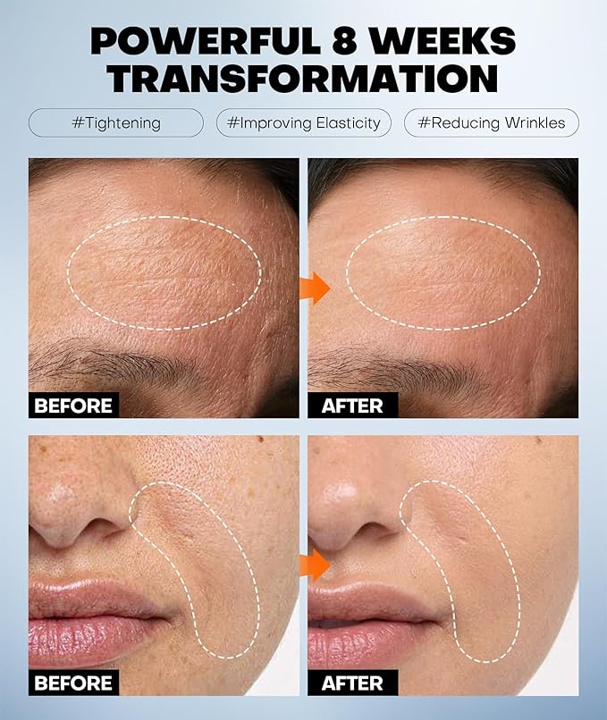 Radiant Glow Collagen Face Mask - Real Deep Overnight Face Masks Skincare with Hyaluronic Acid, Galactomyces Ferment & Vitamin E, Facial Mask for Hydrating, Firming, Plumping & Anti-Aging - 34g x 5ea