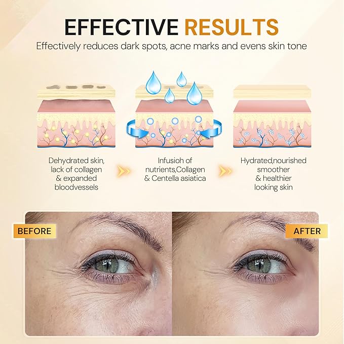 Under Eye Patches, 10 Pairs Gold Collagen Eye Gels Mask, Reduce Dark Circles, Wrinkles Puffy & Bags, Anti-aging Moisturizing Eye Mask by KUTDEP