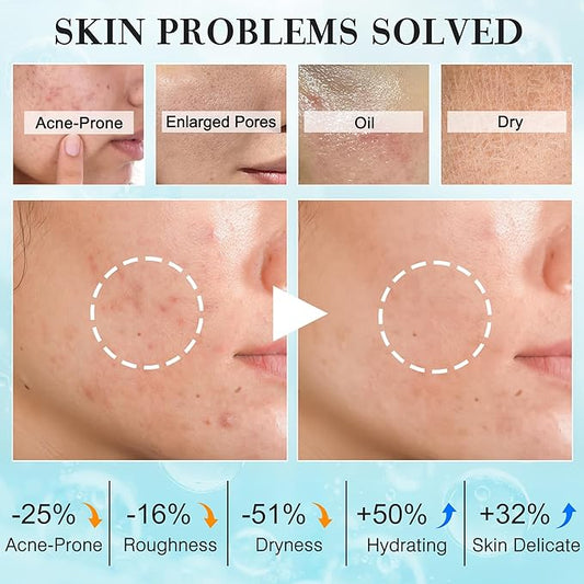 Teen Women Gifts,Skin Care,Skincare,Hydrate,Oil Control,Pore Shrinking,Anti-Allergy Facial Skin Care Routine Kit Travel Size Gift Set Stocking Stuffers for Teen Girls 10-12 16-18 & Women for All Skin