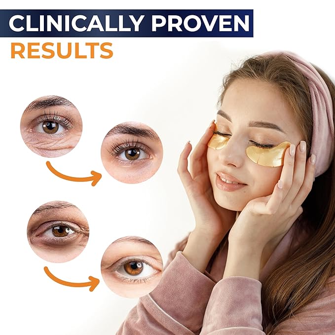 Gold Under Eye Patches For Puffy Eyes And Dark Circles - Overnight eye patches for Anti-Aging with Collagen & Hyaluronic Acid -Under Eyes Mask for Removing Dark Circles, Puffiness & Wrinkles